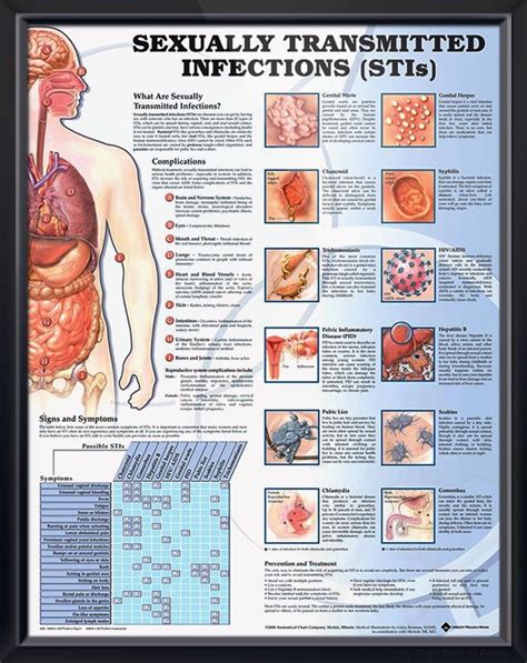 Sexually Transmitted Infections Chart 20x26 Medical Education