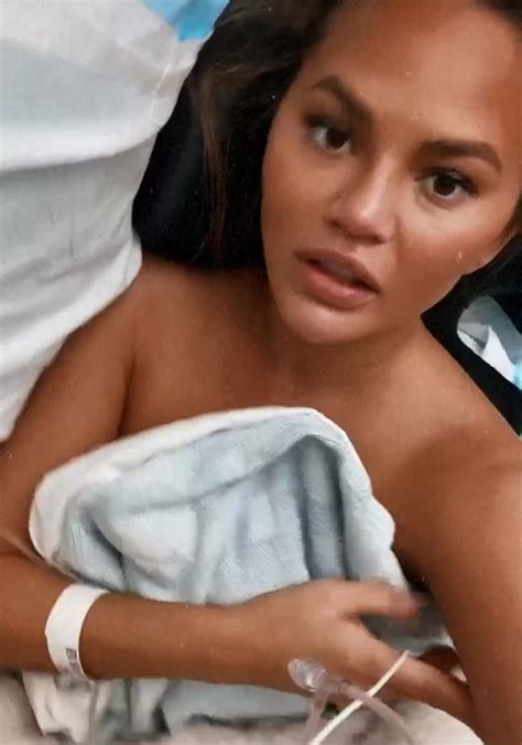 Pregnant Chrissy Teigen Hospitalized After Suffering