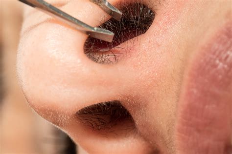 what are the best nose hair removal options we asked the experts