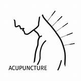 Acupuncture Needles Linie Magen Akupunktur Meridian Punkt Procedure Medicine Clipground sketch template