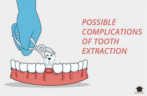 complications  tooth extraction elite dental care tracy elite dental care