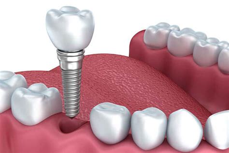 Meeting Evaluation 2019 Florida Dental Convention The Fit Care