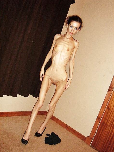 skinny anorexic girls posing and fucking pichunter
