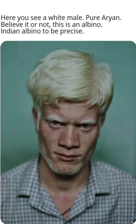 white people  albinos gag