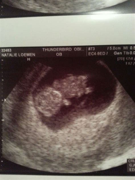 9 weeks pregnant ultrasound little gummy bear 9 weeks pregnant ultrasound 9 weeks