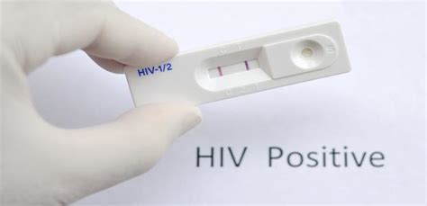 Hiv Diagnosis — 5 Tests To Detect A Recent Hiv Infection