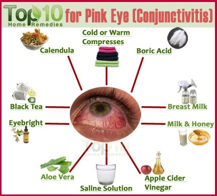 home remedies  pink eye conjunctivitis top  home remedies