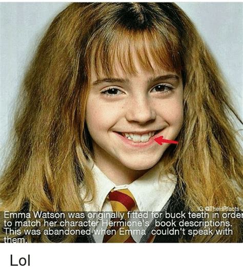 Emma Watson Was Originally Fitted For Buck Teeth In Order