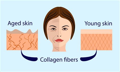 collagen remodeling blog