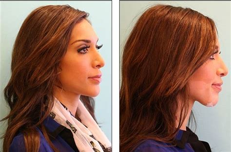 farrah abraham plastic surgery before and after photos