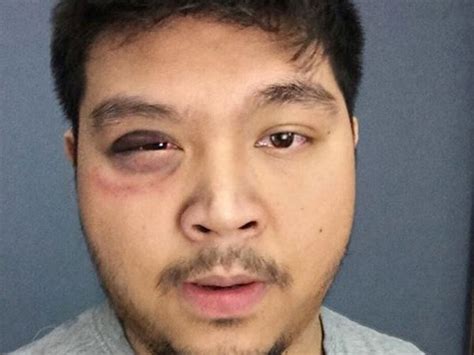 Viral Pinoy In Canada Saves Woman From Her Abusive Partner Coconuts