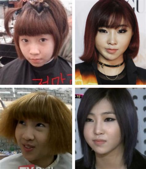 10 shocking photos of korean celebrity plastic surgery amped asia