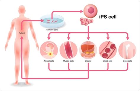 induced pluripotent stem ips cells  medicine  research