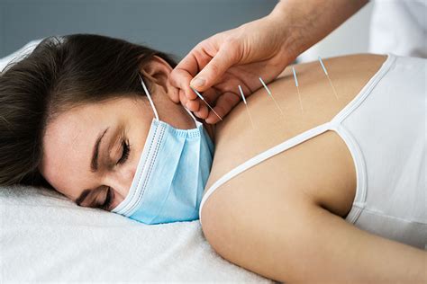 top  dry needling questions answered sport spinal physiotherapy