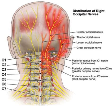 occipital neuralgia facial pain association