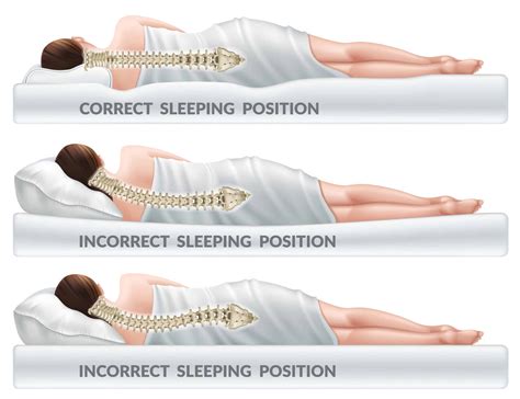 proper spinal alignment  sleeping   recommendations