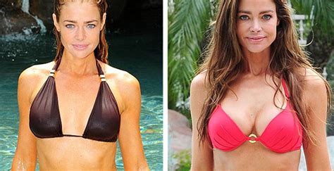 Denise Richards Breast Implants Plastic Surgery Before And