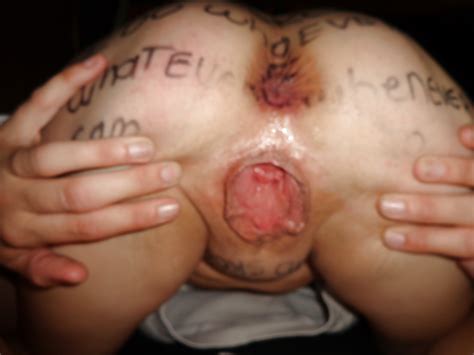 Nasty Slut Well Used Spread Cunt With Pussy Creampie 16