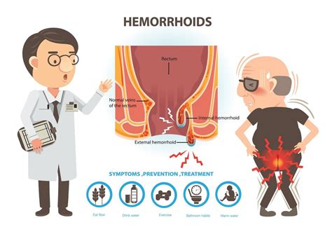 hemorrhoid treatment in kansas city mo colorectal surgery