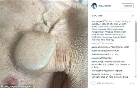 Pathologist Nicole Angemi Instagrams Pictures Of Dead