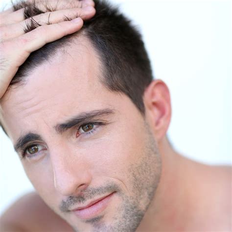 When Do Men Go Bald Toronto Hair Transplant Clinic