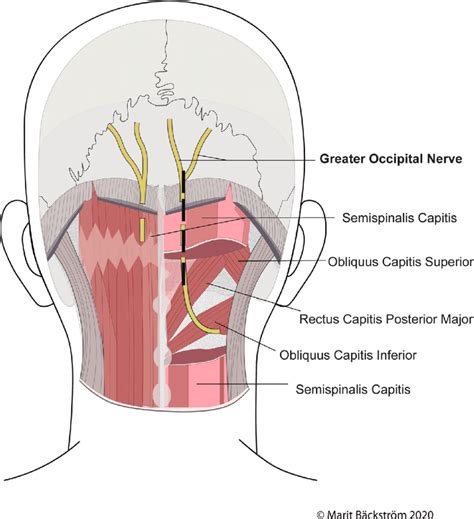 posterior part   craniocervical region depicted  bilateral