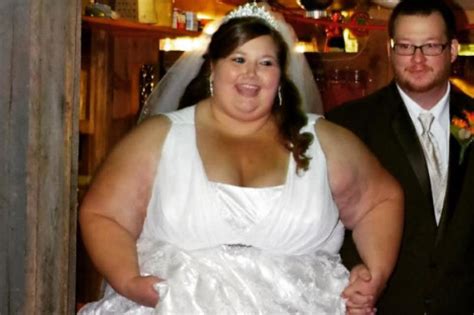 Obese Woman Loses 20st Naturally You Won’t Believe What