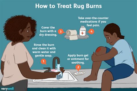 Rug Burns Overview Symptoms Severity Treatment
