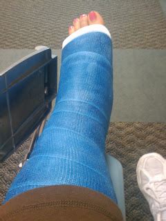 diary   broken ankle hard cast