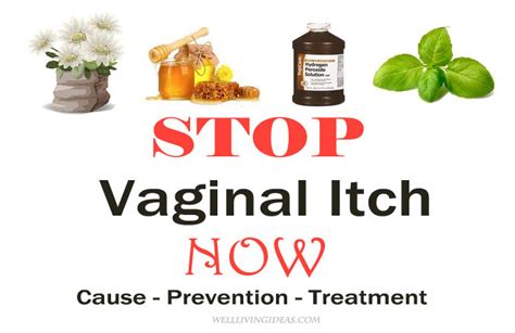 12 Proven Home Remedies For Vaginal Itching Burning And Irritation