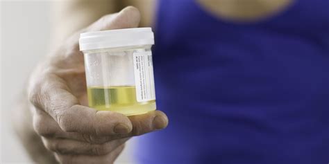Urine Test Why And How A Urine Test Is Carried Out And What It Can