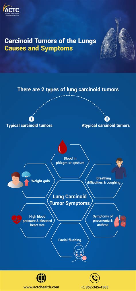 Lung Carcinoid Tumor Causes And Symptoms Actc