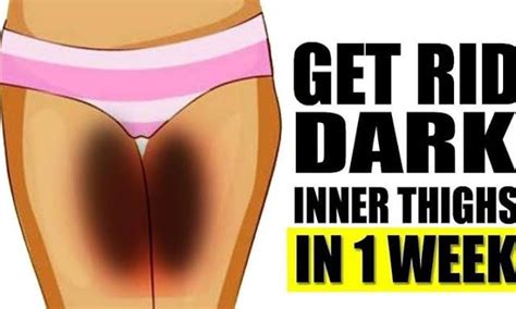 Natural Ways To Get Rid Of Dark Inner Thighs In Just 7 Days Dark