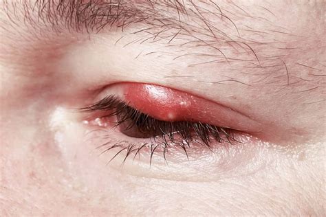 symptoms  eye problems  shouldnt ignore