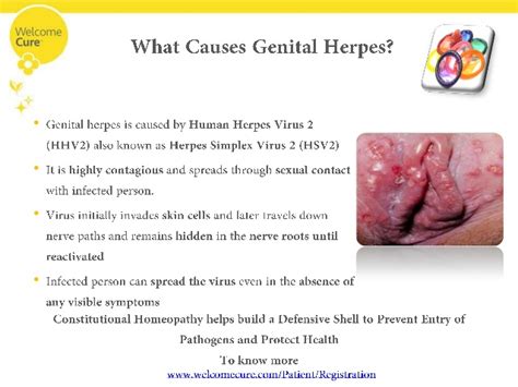 female external causes symptoms treatment genitalia female