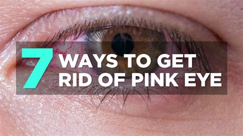 How To Get Rid Of Pink Eye Health