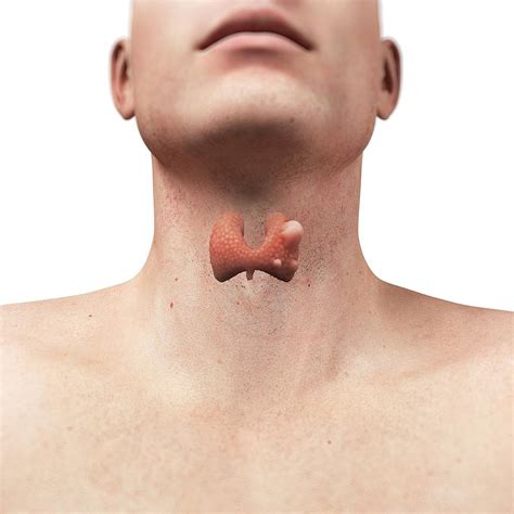 thyroid gland cancer photograph by sciepro science photo library fine