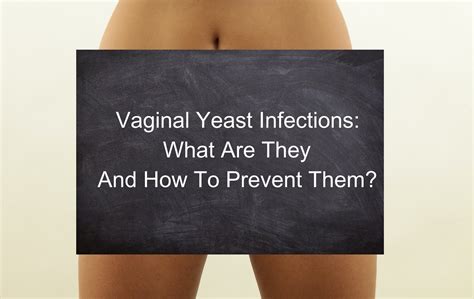 white vaginal discharge yeast infection