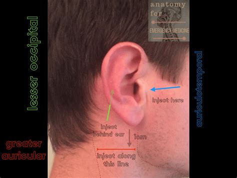 sensory innervation   ear emergency medicine ireland