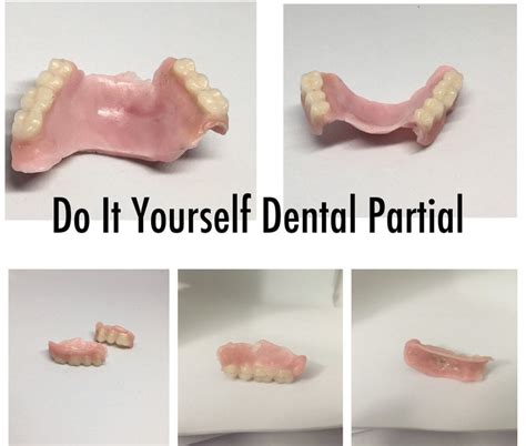 Do It Yourself Denture Kit Make Your Own Temporary Denture Dental