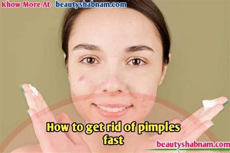 rid  pimples fast  natural ways   rid  pimples