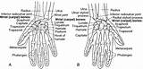 Wrist Joints Intercarpal Carpal Medical Term sketch template