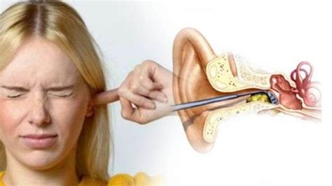 telinga sakit  berdengung homecare