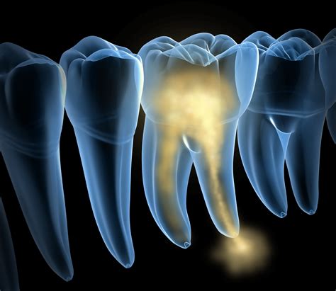 common signs  tooth nerve damage sunrise oral surgery