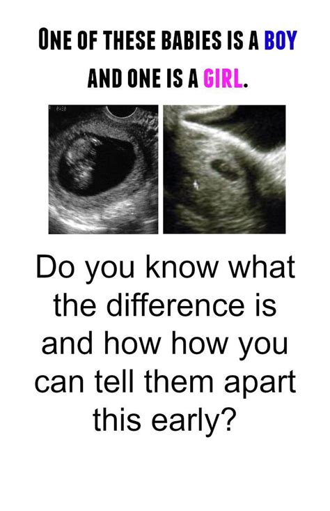 197 best images about about early pregnancy on pinterest week by week trimesters of pregnancy