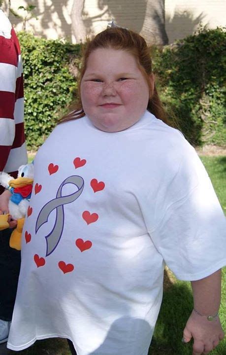 starving and obese girl fights for needed surgery