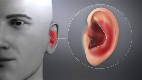 cure ear infection   day health gadgetsng
