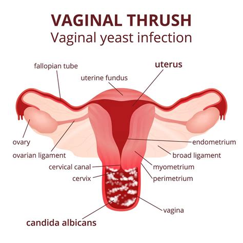 Causes Of A Bad Vaginal Odor Std Gov Blog