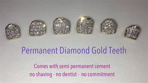 permanent diamond teeth price    price  switches