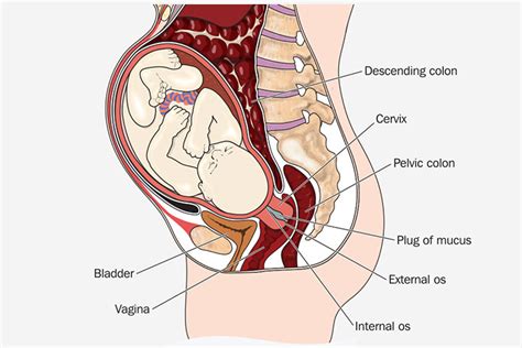 uterine prolapse in pregnancy signs causes and treatment